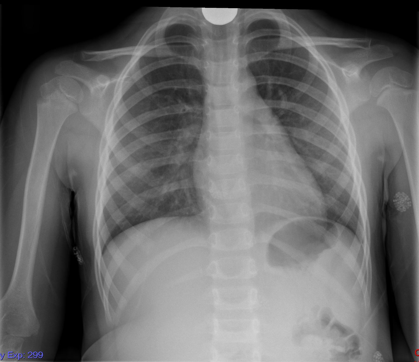 Case 8